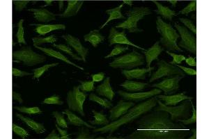 Immunofluorescence of monoclonal antibody to ABTB1 on HeLa cell.