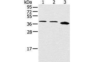 Western blot analysis of Jurkat Hela and 231 cell using CCNG1 Polyclonal Antibody at dilution of 1:400