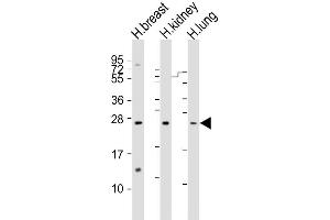 Image no. 5 for anti-Adrenomedullin (ADM) (AA 69-96) antibody (ABIN651196)