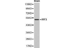 Image no. 1 for anti-Interferon Regulatory Factor 3 (IRF3) antibody (ABIN1513098)