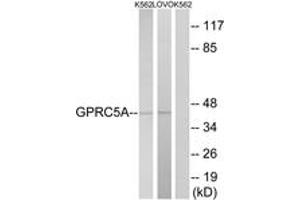 Image no. 1 for anti-G Protein-Coupled Receptor, Family C, Group 5, Member A (GPRC5A) (AA 140-189) antibody (ABIN1535989)