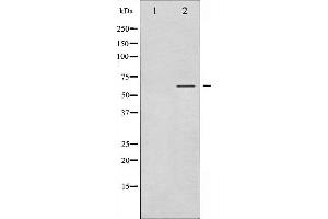 Image no. 8 for anti-serum/glucocorticoid Regulated Kinase 1 (SGK1) (pSer422) antibody (ABIN6256329)