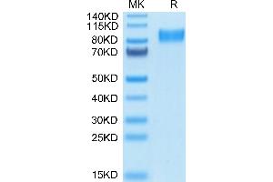 Osteoactivin Protein (GPNMB) (His tag)