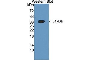 Image no. 2 for anti-NUAK Family, SNF1-Like Kinase, 1 (NUAK1) (AA 421-658) antibody (ABIN5014026)