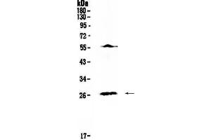 anti-Interleukin 17A (IL17A) (AA 26-158) antibody