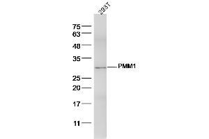 anti-Phosphomannomutase 1 (PMM1) (AA 31-130) antibody