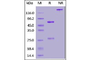 SDS-PAGE (SDS) image for anti-SARS-CoV-2 Spike S1 antibody (ABIN6953206)