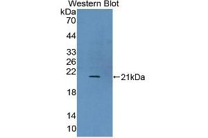 Image no. 1 for anti-Ubiquitously-Expressed, Prefoldin-Like Chaperone (UXT) (AA 11-157) antibody (ABIN5014501)