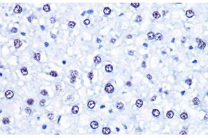 Immunohistochemistry of paraffin-embedded Rat liver using CHD4 Polyclonal Antibody at dilution of 1:100 (40x lens).