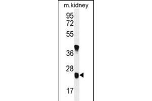 UNC119B Antikörper  (C-Term)