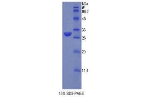 Image no. 1 for Sulfatase Modifying Factor 1 (SUMF1) (AA 113-356) protein (His tag) (ABIN1877631)