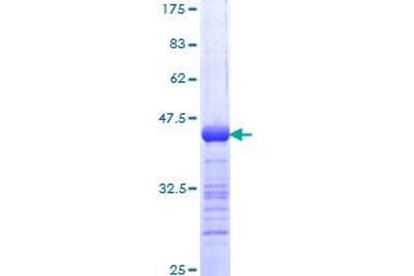URI1 Protein (AA 371-475) (GST tag)