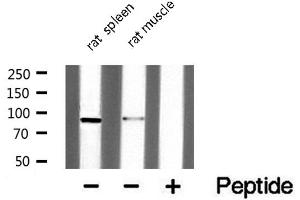 Image no. 2 for anti-Dual-Specificity tyrosine-(Y)-phosphorylation Regulated Kinase 1A (DYRK1A) (N-Term) antibody (ABIN6257024)
