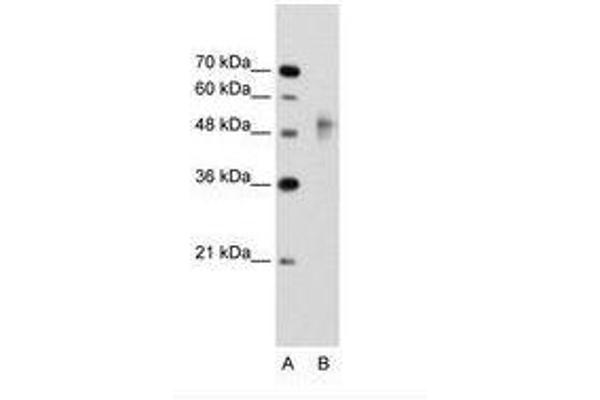 RNF38 Antikörper  (AA 21-70)