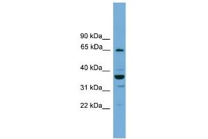 Image no. 1 for anti-TH1-Like (TH1L) (N-Term) antibody (ABIN2787403)