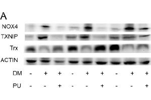 TXNIP antibody  (AA 1-166)