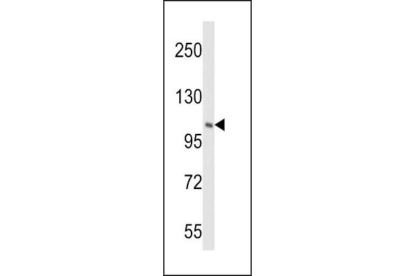 PI4KB Antikörper  (AA 519-548)