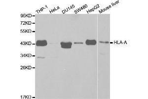 Image no. 2 for anti-Major Histocompatibility Complex, Class I, A (HLA-A) antibody (ABIN3023100)