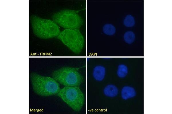 anti-Transient Receptor Potential Cation Channel, Subfamily M, Member 2 (TRPM2) (Internal Region) antibody