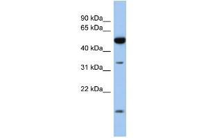 Image no. 1 for anti-Retinol Dehydrogenase 12 (All-Trans/9-Cis/11-Cis) (RDH12) (Middle Region) antibody (ABIN2785176)