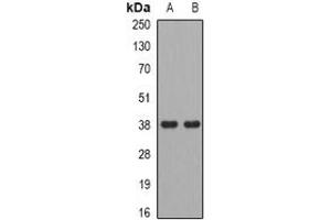 Image no. 2 for anti-Alcohol Dehydrogenase 5 (Class III), chi Polypeptide (ADH5) (full length) antibody (ABIN6043134)