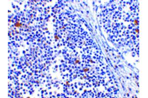 Image no. 3 for anti-Interferon Induced with Helicase C Domain 1 (IFIH1) (Internal Region) antibody (ABIN6655947)