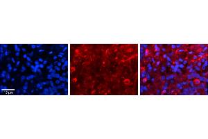 SLC27A6 antibody  (Middle Region)