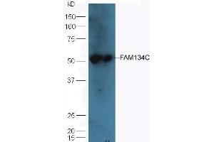 Image no. 1 for anti-Family with Sequence Similarity 134, Member C (FAM134C) (AA 76-180) antibody (ABIN872917)