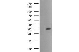 Image no. 6 for anti-Musashi Homolog 2 (MSI2) antibody (ABIN1499578)