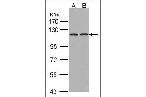 Image no. 3 for anti-Glutamyl Aminopeptidase (Aminopeptidase A) (ENPEP) (Tyr182) antibody (ABIN615545)