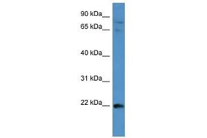Image no. 1 for anti-Mitogen-Activated Protein Kinase Kinase Kinase 15 (MAP3K15) (Middle Region) antibody (ABIN630660)