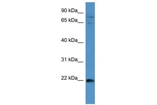 anti-Mitogen-Activated Protein Kinase Kinase Kinase 15 (MAP3K15) (Middle Region) antibody