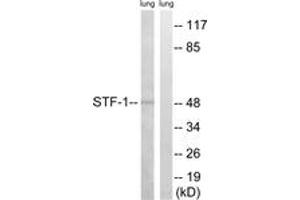 Image no. 1 for anti-Nuclear Receptor Subfamily 5, Group A, Member 1 (NR5A1) (AA 169-218) antibody (ABIN2889160)