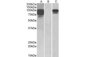 Image no. 2 for anti-Proprotein Convertase Subtilisin/kexin Type 9 (PCSK9) (AA 214-228) antibody (ABIN570954)