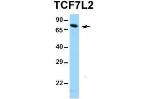 Image no. 2 for anti-Transcription Factor 7-Like 2 (T-Cell Specific, HMG-Box) (TCF7L2) (Middle Region) antibody (ABIN2777927)