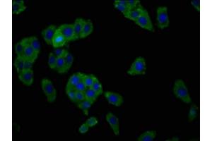 SLC7A1 antibody  (AA 430-492)