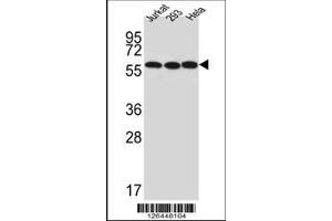 Image no. 1 for anti-UTP6, Small Subunit (SSU) Processome Component, Homolog (UTP6) (AA 16-43), (N-Term) antibody (ABIN651489)