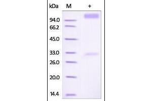 Image no. 1 for Interferon alpha/beta Receptor 1 (IFNAR1) (AA 28-436) protein (Fc Tag) (ABIN2181250)