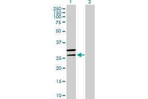 Image no. 1 for anti-Mitochondrial Ribosomal Protein L2 (MRPL2) (AA 1-305) antibody (ABIN526429)
