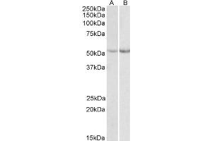 Image no. 2 for anti-Phenylalanine Hydroxylase (Internal Region) antibody (ABIN571236)