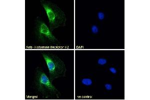 Image no. 1 for anti-Histamine Receptor H2 (HRH2) (C-Term) antibody (ABIN185463)