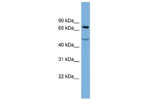 Image no. 2 for anti-Stromal Interaction Molecule 1 (STIM1) (Middle Region) antibody (ABIN2782215)