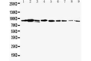 Image no. 1 for anti-Signal Transducer and Activator of Transcription 1, 91kDa (STAT1) (AA 364-378), (Middle Region) antibody (ABIN3043693)