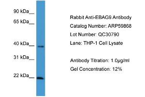 Image no. 1 for anti-Estrogen Receptor Binding Site Associated, Antigen, 9 (EBAG9) (C-Term) antibody (ABIN2788244)
