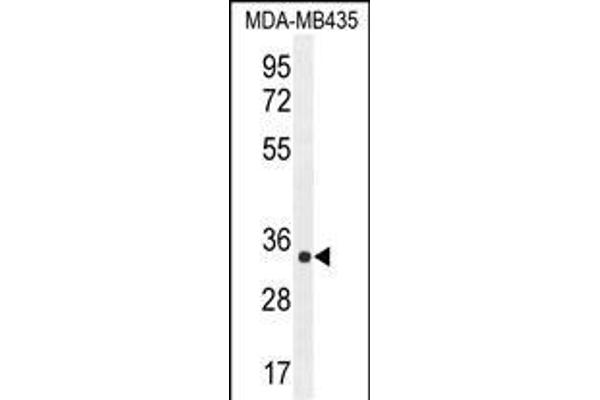 ALKBH6 antibody  (AA 116-145)