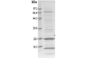 Image no. 1 for Tripartite Motif Containing 33 (TRIM33) (AA 959-1059) protein (His tag,DYKDDDDK Tag) (ABIN2669632)