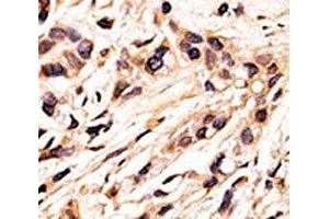 Image no. 3 for anti-Retinoblastoma Protein (Rb Protein) (pSer608) antibody (ABIN3028977)