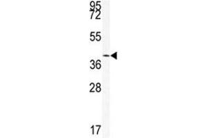 Image no. 2 for anti-Sirtuin 6 (SIRT6) (AA 290-319) antibody (ABIN3032598)