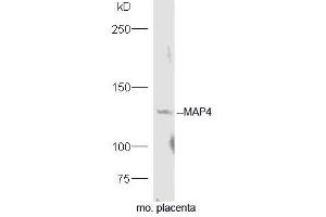 Image no. 2 for anti-Microtubule-Associated Protein 4 (MAP4) (AA 701-800) antibody (ABIN754243)
