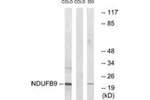 Image no. 1 for anti-NADH Dehydrogenase (Ubiquinone) 1 beta Subcomplex, 9, 22kDa (NDUFB9) (AA 102-151) antibody (ABIN1535062)